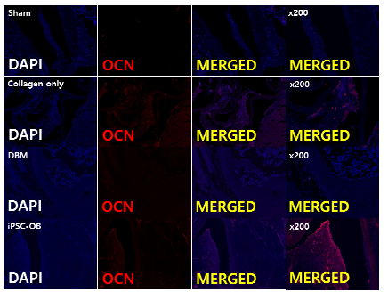 OCN antibody을 이용한 면역형광염색