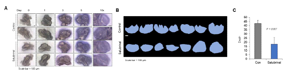 Dusp2 억제제 처리에 따른 tooth germ의 효과를 평가. (A) salubrinal (50 μM) 처리 하였을 때 모양 변화 확인 (B) salubrinal (50 μM)을 5일간 처리한 후 모양 확인 (C) salubrinal (50 μM) 처리 하였을 때 모양 변화 분석