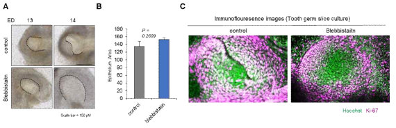 생쥐 배아의 치배 절편 배양 모델의 마이오신 억제에 따른 변화. (A) Blebbistatin을 24시간 처리 하였을 때 bud-cap stage 의 치배 변화 양상 (B) Blebbistatin을 24시간 처리 하였을 때 상피 면적 차이 (C) Blebbistatin을 24시간 처리 하였을 때 Ki-67 면역 형광 염색 이미지