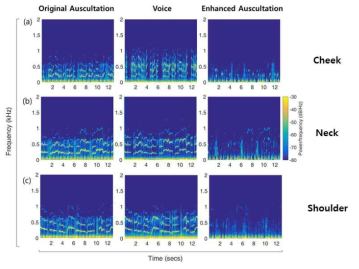 목소리와 혼합된 청진음에서 볼, 뒷목, 어깨 각각에서 수집된 목소리 샘플을 제거하여 얻은 순수 청진음의 스펙트로그램