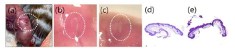 in utero 배아 상처모델의 제작(a)과 E14 배아의 피부에 상처를 낸 후 각각 1일, 2일이 지난 상처부위의 모습(b, c)과 상처조직 절편으로 HE 염색을 한 그림(d, e)