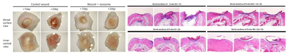 9주령 수컷 생쥐를 이용한 상처모델에서 양수 유래 exosome을 처리하여 상처치유효과를 확인하기 위해 채취한 피부조직(좌)과 연속절편의 H&E 염색으로 조직의 구조를 살펴본 그림(우)
