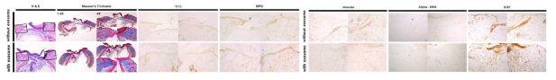 9주령 수컷 생쥐를 이용한 상처모델에 양수 유래 exosome을 처리하여 분석한 결과