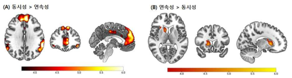 시간적 연속성과 동시성의 뇌 활성화 차이 지도