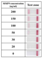 측방 유동 면역 분석 키트를 이용한 MMP9의 농도별 분석 이미지