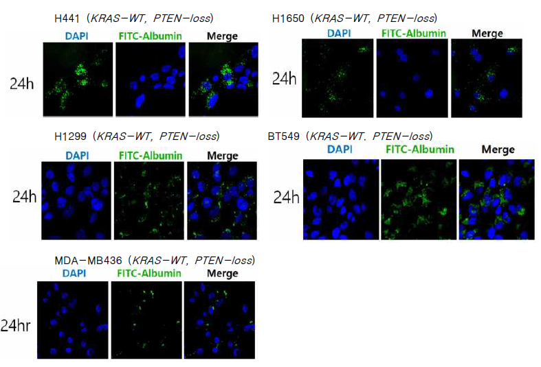 5종의 PTEN 결손 폐암 모델에서 관찰된 세포 내 알부민 흡수 증가 현상