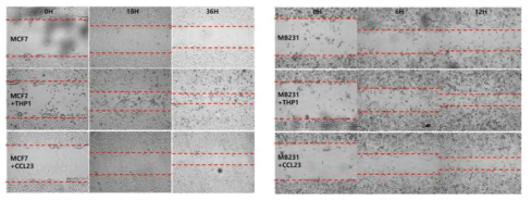 wound healing assay