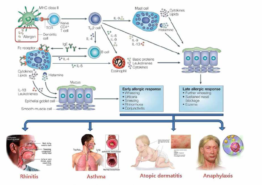 알레르기 질환의 pathogenesis