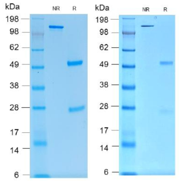 생산된 Chimeric 항체의 non-reducing, reducing SDS-PAGE gel loading 결과 (좌 15E5, 우 15H2)