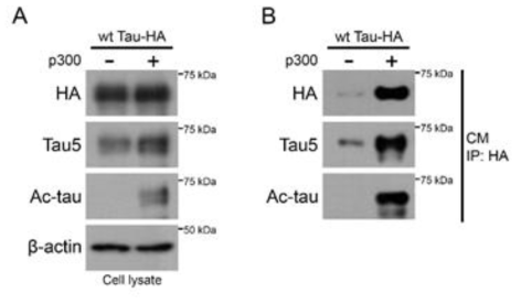 Tau 단백질의 아세틸화에 따른 secretion 확인