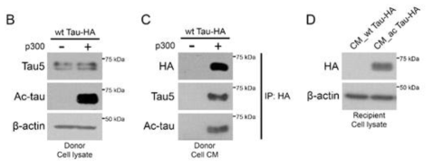 Acetyl-Tau의 Propagation 확인