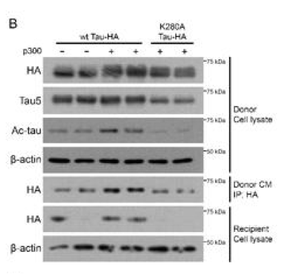 Tau 단백질의 acetylation을 억제했을 때 타우 전파 확인