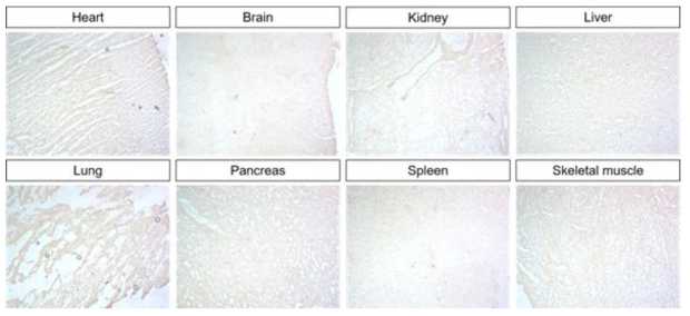 ADEL-Y01h 항체의 Tissue Cross Reactivity (TCR)