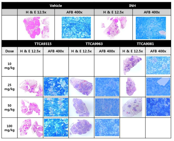 TTCA 화합물의 Lung Histopathology