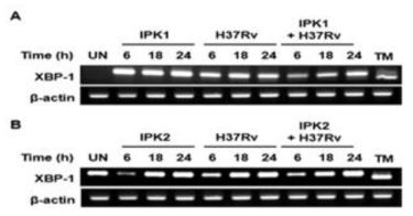 대식세포 내 결핵균 감염 시 TTCA 화합물 처리에 따른 XBP-1 mRNA 분석