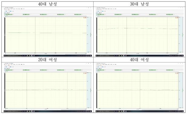 성별과 연령이 다른 피험자의 피부 전도도 측정 결과