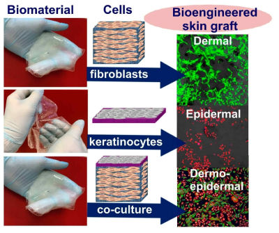 생체소재 내 피부세포 배양을 통해 인공피부 구현