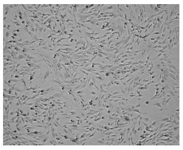 배양된 NIH3T3 섬유아세포