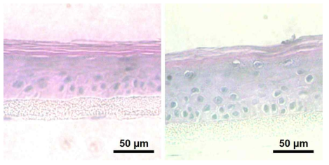 플라즈마 노출 전, 후 인공피부조직의 H&E 염색 이미지