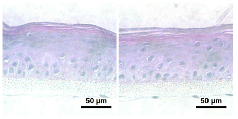촉매모듈 통과 전, 후 인공피부조직의 H&E 염색 이미지