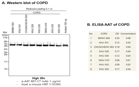 COPD 환자의 혈장에서 AAT 발현량 분석. A. COPD 환자의 혈장을 PBS에 100배 희석시키고 10 ul를 SDS-PAGE 영동하고 항-AAT 항체로 감지함. B. COPD 환자의 혈장을 PBS에 5,000 희석해서 ELISA AAT 키트로 단백질량을 분석함