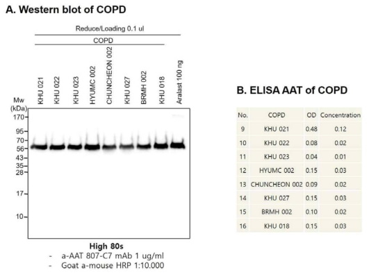 COPD 환자의 혈장에서 AAT 발현량 분석. A. COPD 환자의 혈장 0.1ul를 SDS-PAGE 영동하고 항-AAT 항체로 감지함. B. COPD 환자의 혈장을 PBS에 1/5,000 희석해서 ELISA AAT 키트로 단백질량을 분석함