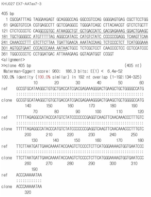 COPD 환자의 AAT exon 7번 염기서열 분석. reference 유전자와 100% 일치함