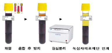 SST 원심분리 방법