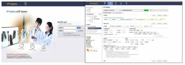 특발성 폐섬유증 코호트 web-based registry 화면