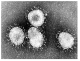 Electromicroscopic photo of Coronavirus