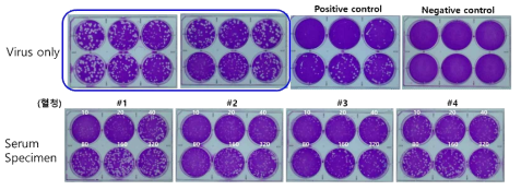 중화항체 분석을 위한 PRNT법 확립