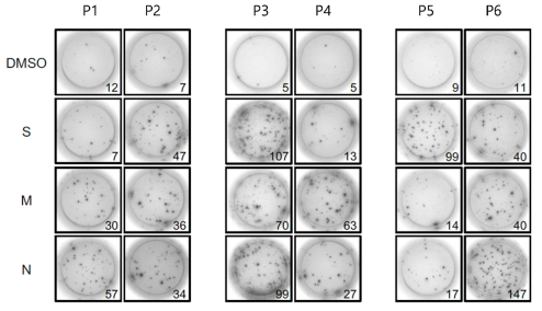 COVID-19 환자 PBMC의 IFN-γ ELISPOT assay 분석 결과