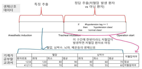 Static 방식의 이상발생 환자 모델링 방법