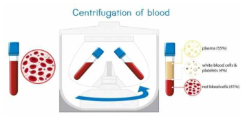 원심분리 후 혈장분리