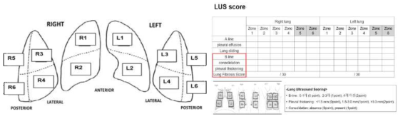 12개의 pulmonary zone 및 평가항목