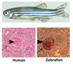 Zebrafish에서 보이는 cellular organized structure. M. marinum 균주는 zebrafish를 숙주로 삼아 증식 할 수 있으며, 인간의 결핵에서 보이는 바와 같이 매우 유사한 육아종을 zebrafish 안에서 형성한다는 것이 H&E 염색을 통하여 확인되었다