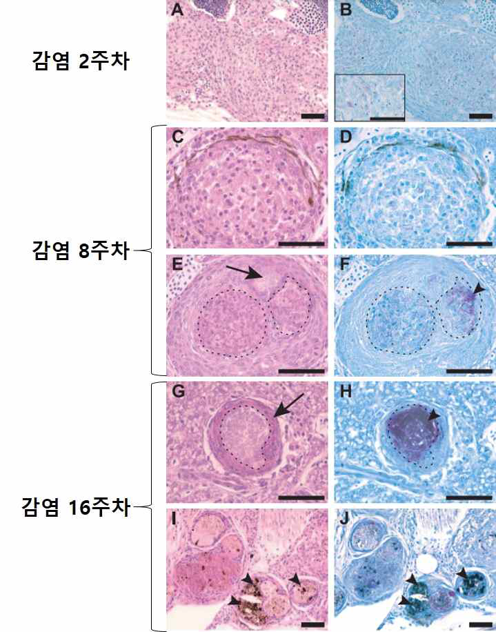 50 CFU 이하의 M. marinum 감염 시기에 따른 육아종 생성