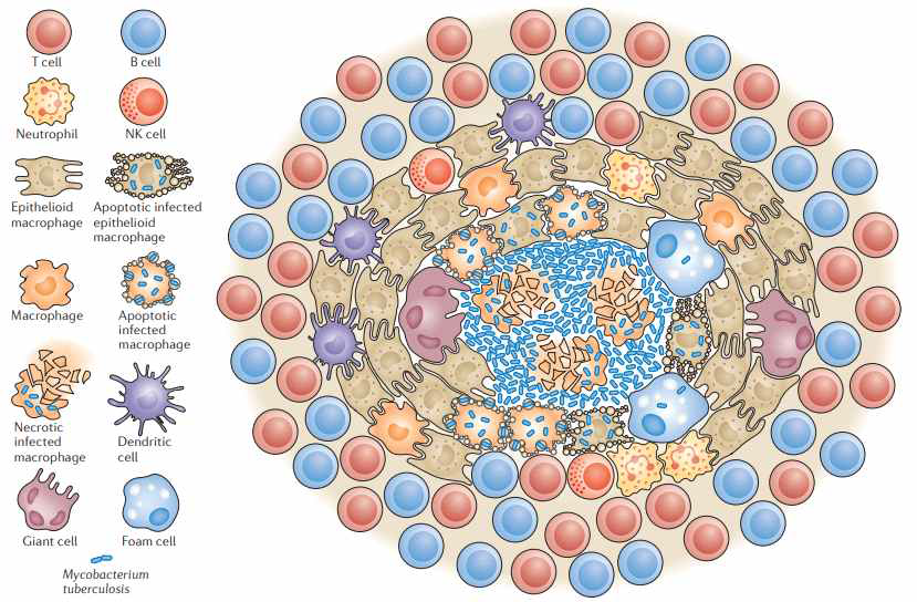 결핵 육아종을 구성하는 다양한 면역 세포의 조성과 구조