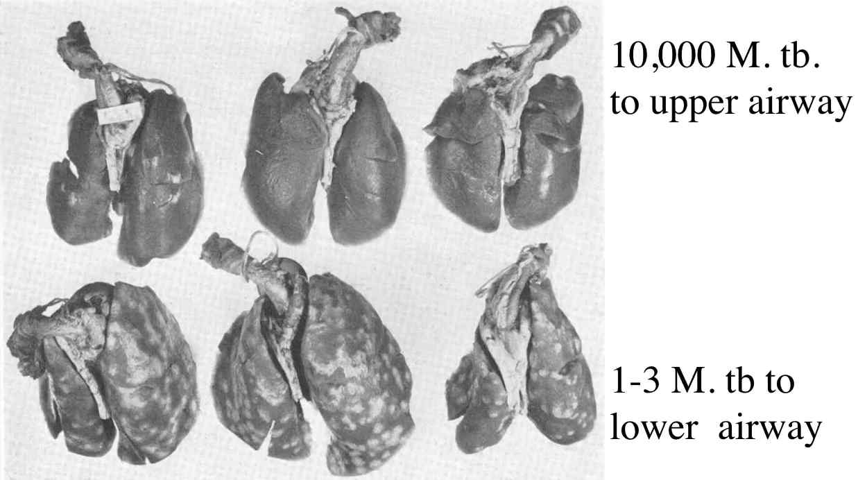 결핵은 주로 호흡기의 하부 (lower respiratory tract)에 감염되어 육아종을 형성한다