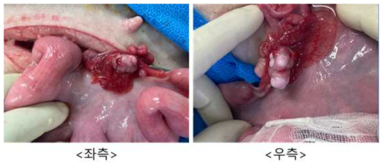 3월 28일 embryo transfer #GB-35, 좌측/우측 난소 상태