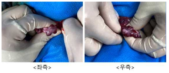 6월 10일 embryo transfer #M7-27, 좌측/우측 난소 상태