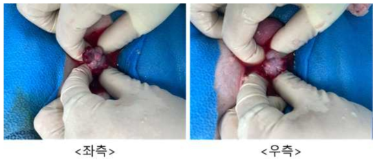 7월 18일 embryo transfer #GD-40, 좌측/우측 난소 상태
