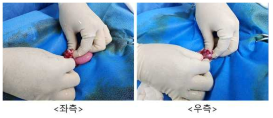 10월 31일 embryo transfer #GF-06, 좌측/우측 난소 상태