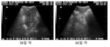#GF-04 초음파 측정 사진, 이식 후 38일/66일