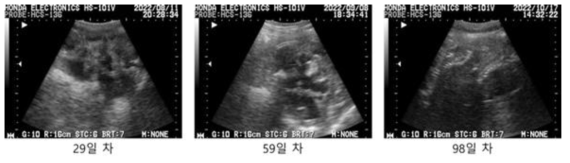 #GD-14 초음파 측정 사진, 이식 후 29일/59일/98일