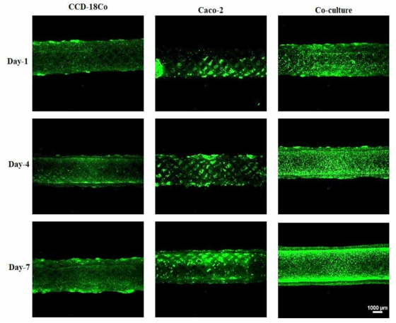 CCD-18Co, Caco-2, Co-culture 그룹 내 세포의 Live 사진