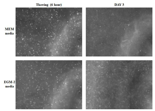 CCD-18Co 세포의 배양 (MEM media VS EGM-2 media)