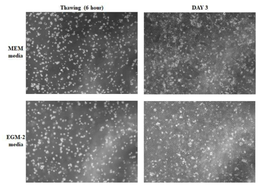 Caco-2 세포의 배양 (MEM media VS EGM-2 media)