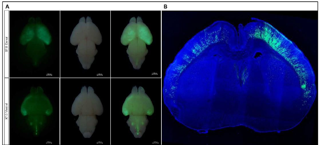 CCN3-BAC-Gfp 형질전환 마우스의 대뇌에서 GFP가 deep layer 특이적 발현하고 있음을 확인. (A) Whole brain image. (B) Coronal section을 통한 GFP 발현 확인