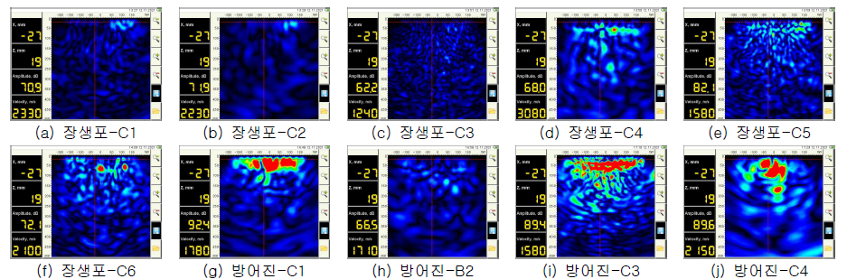 MIRA를 활용한 B-scan image